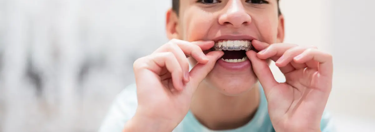 Ragazzo che indossa un apparecchio trasparente per i denti