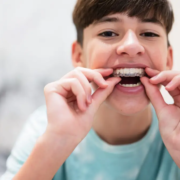 Ragazzo che indossa un apparecchio trasparente per i denti