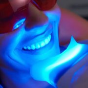 Trattamento di sbiancamento dentale con luce LED Paziente con occhiali protettivi sorride durante trattamento di sbiancamento dentale con luce LED blu
